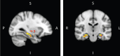 Fig.2
