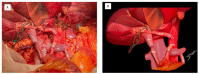 Figure 1 -