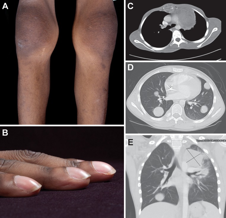 Fig. 1