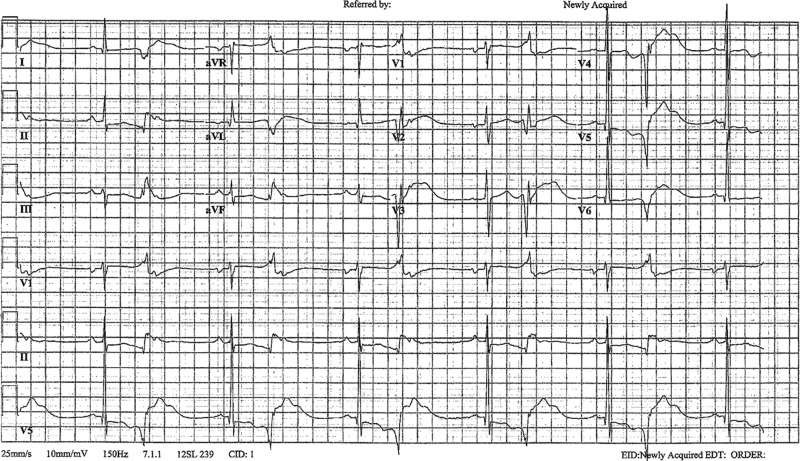 Figure 2