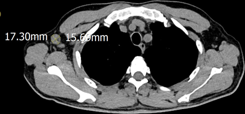 Figure 2