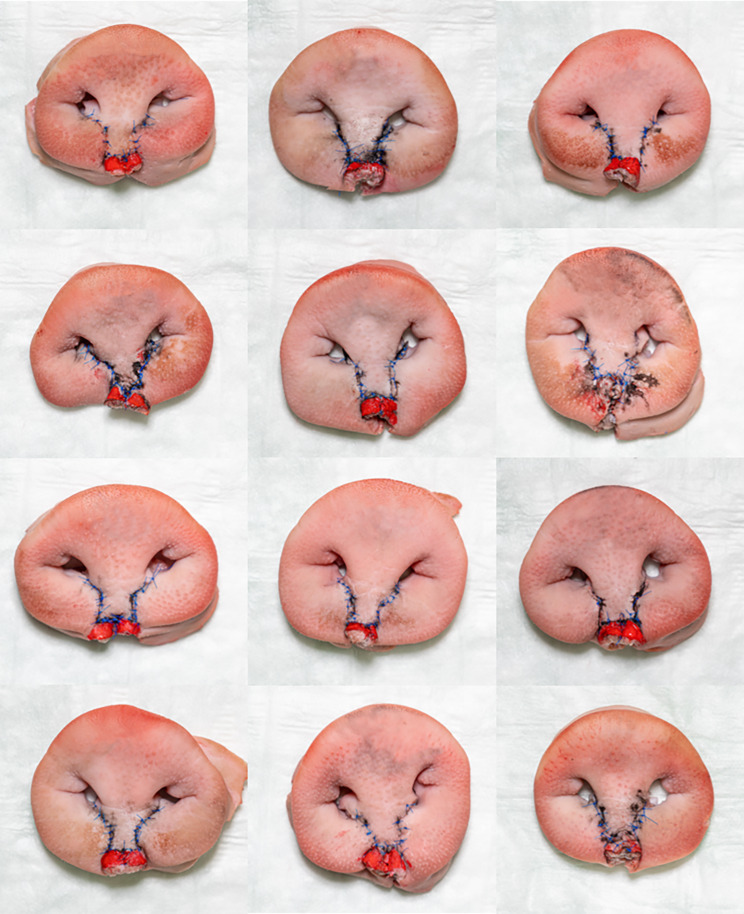 Fig. 11