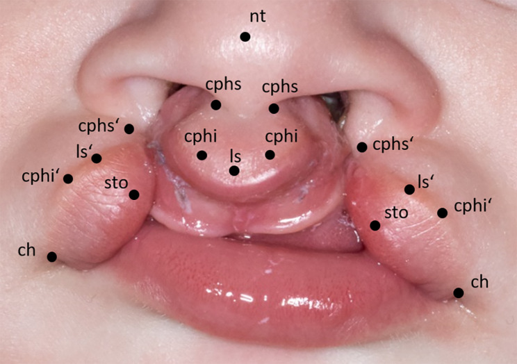 Fig. 1
