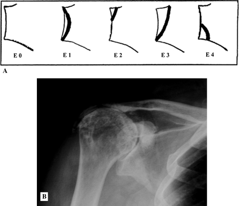 Fig. 3A–B