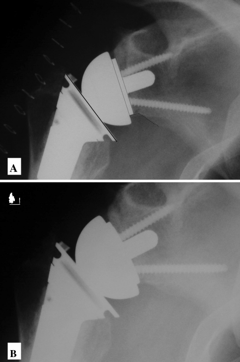 Fig. 5A–B