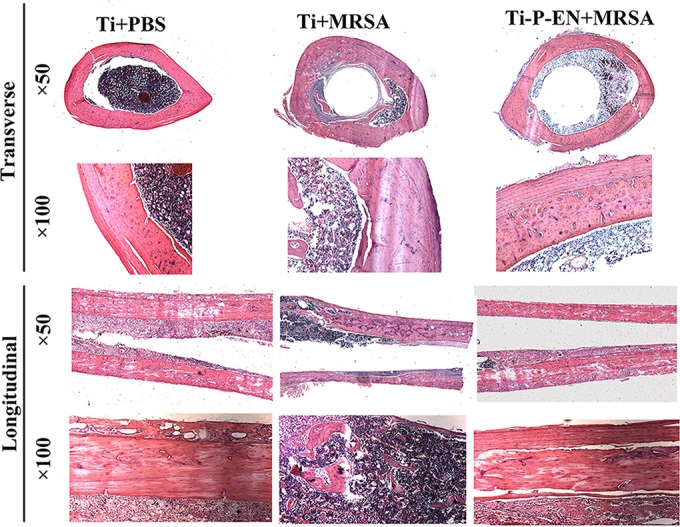 FIG 11