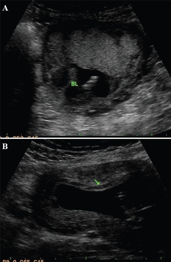 Figure 6 (A, B)