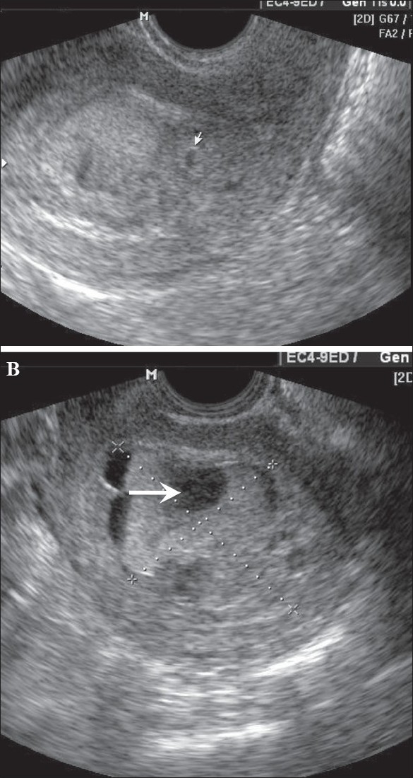 Figure 13 (A,B)