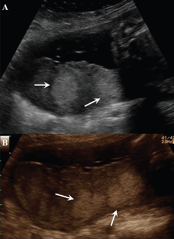 Figure 15 (A,B)