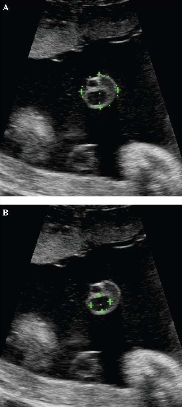 Figure 21 (A,B)