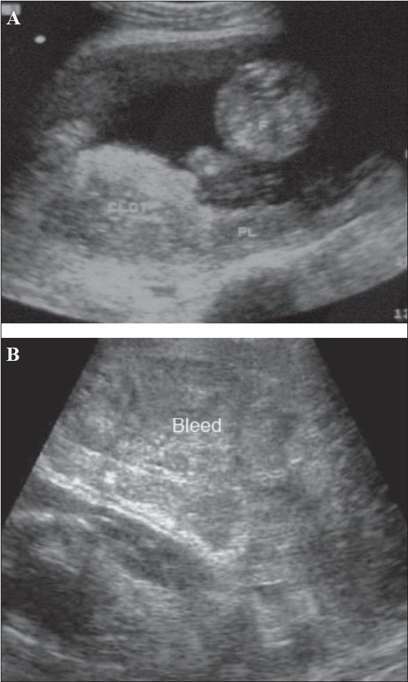 Figure 8 (A, B)