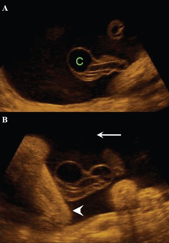 Figure 28 (A,B)