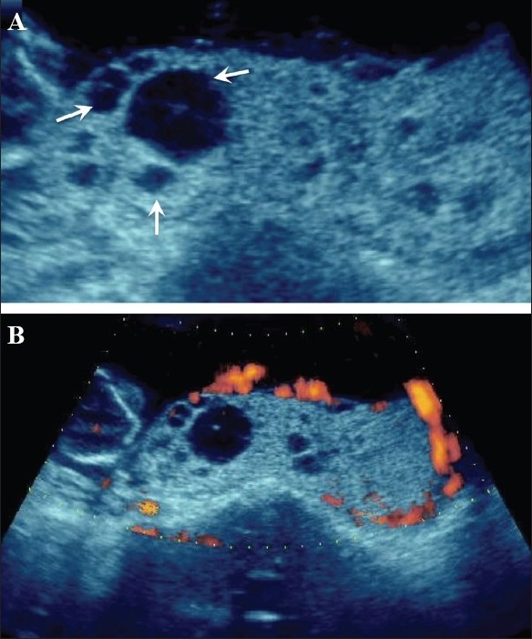 Figure 5 (A, B)