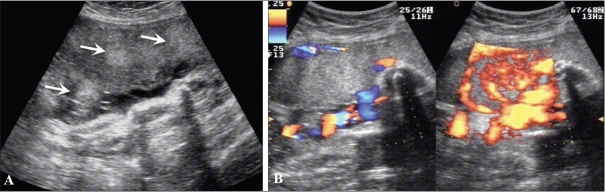 Figure 3 (A-B)