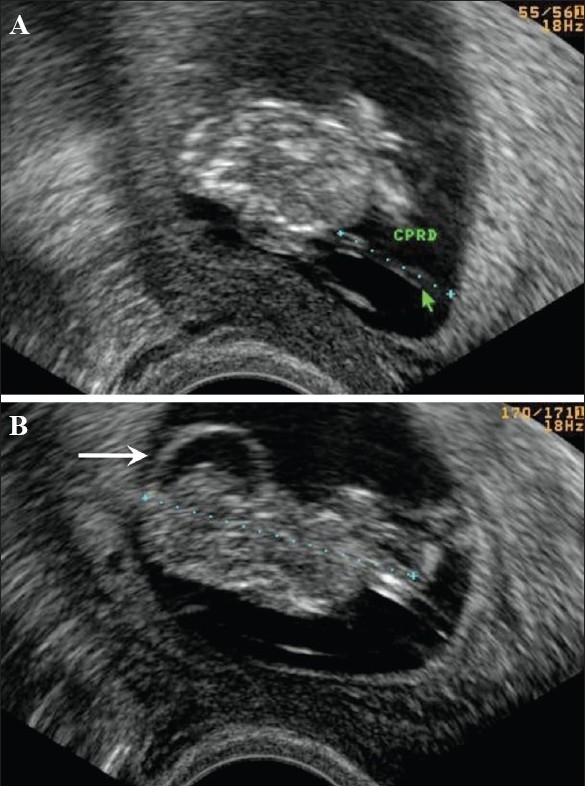 Figure 24 (A, B)