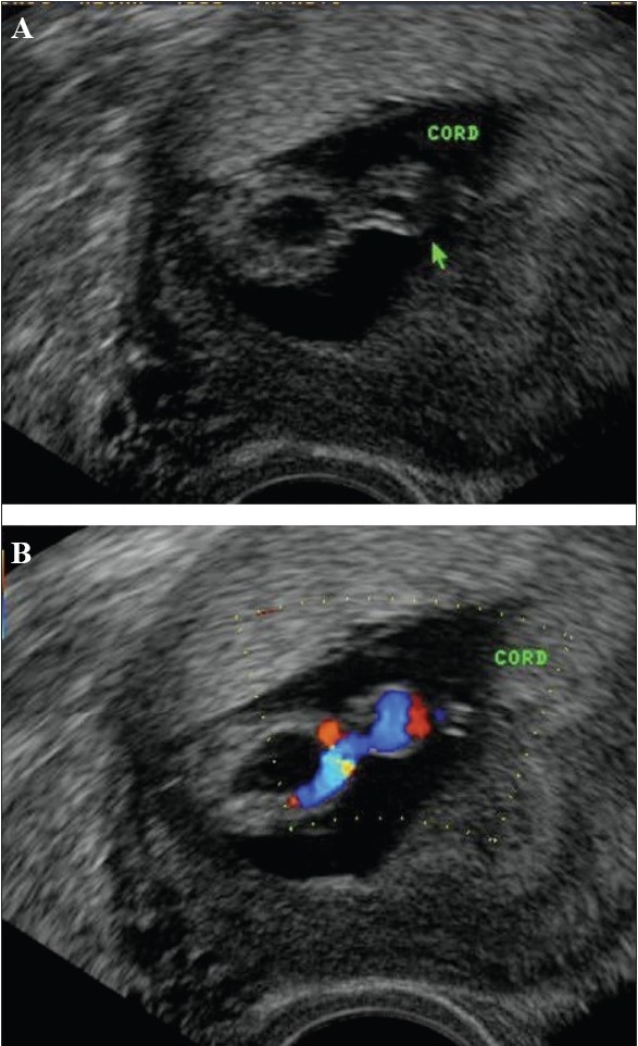 Figure 23 (A,B)