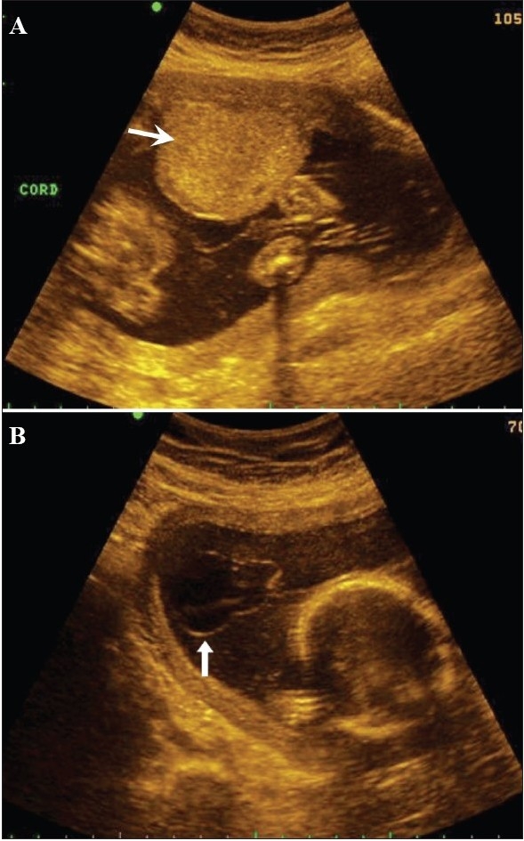 Figure 4 (A-B)