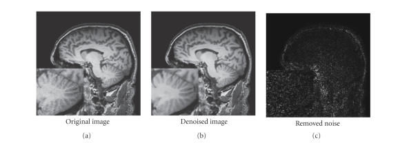 Figure 11