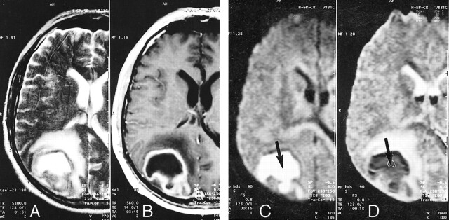 fig 4.