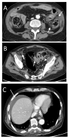 Figure 12