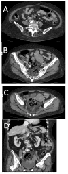 Figure 11