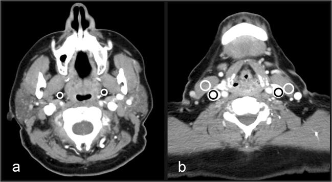 Fig. 2