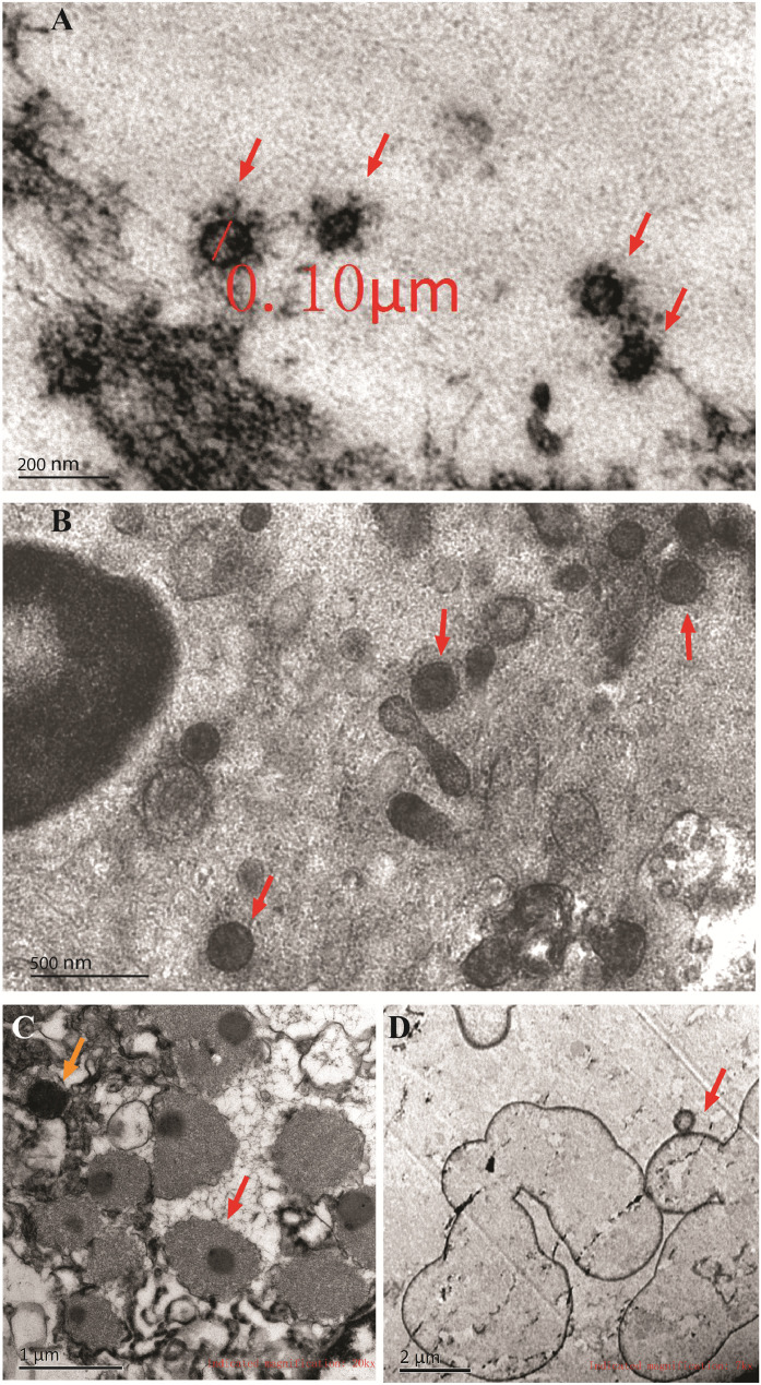 Figure1.