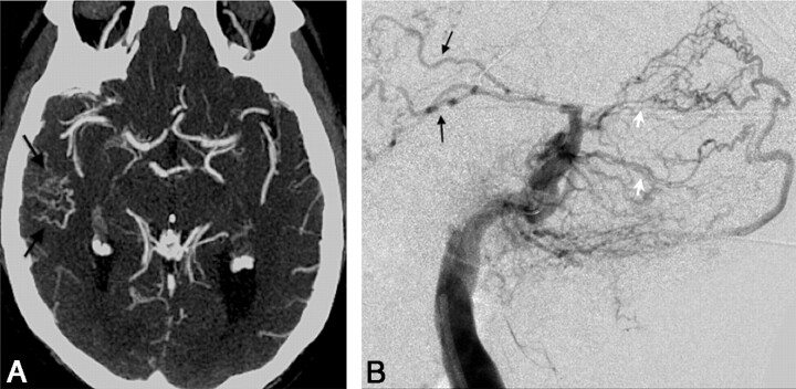 Fig 4.