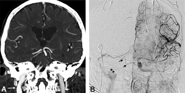 Fig 3.