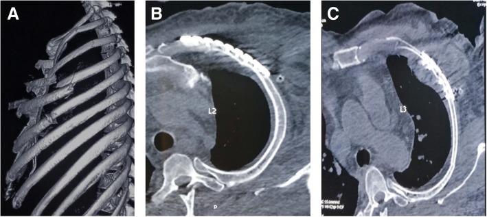 Fig. 5