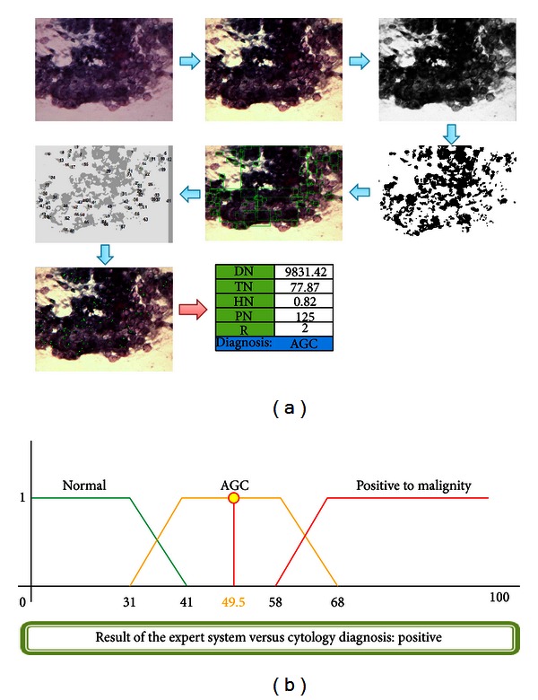 Figure 18