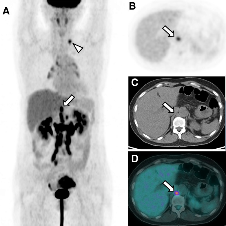 Fig. 2