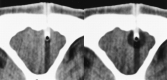 <sc>fig</sc> 5.