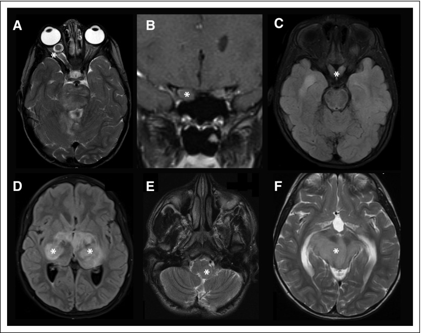 Fig 1.