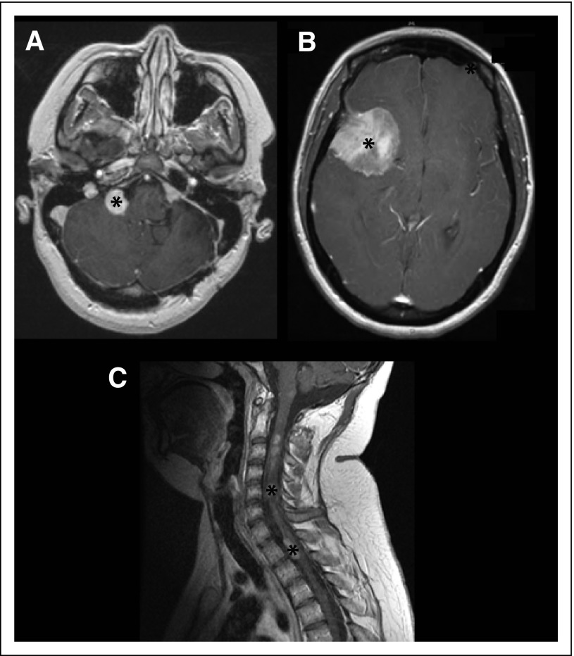 Fig 2.