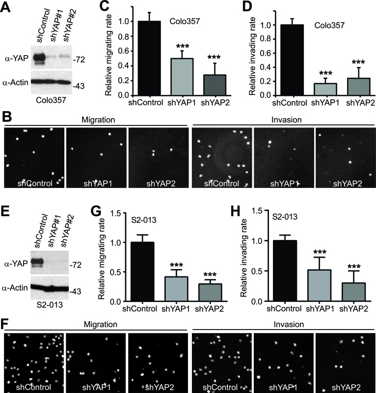 Active YAP promotes pancreatic cancer cell motility, invasion and ...