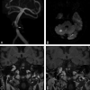 Fig 3.