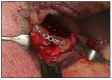 Fig. (8)