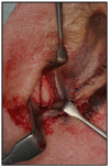 Fig. (5)
