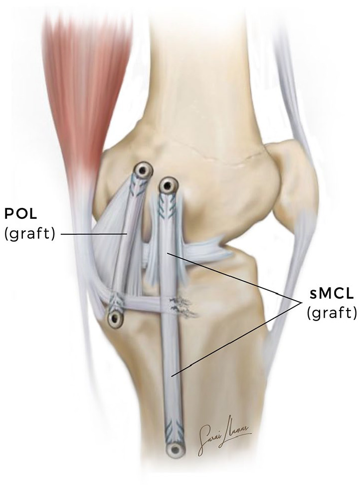 Fig. 5