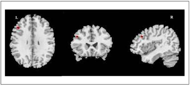 FIGURE 2