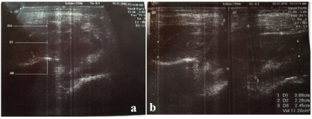 [Table/Fig-5a,b]: