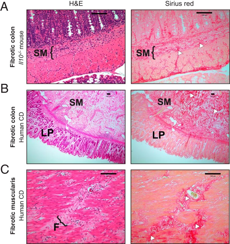 FIG 3