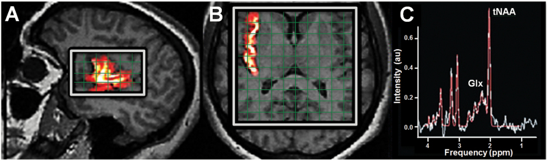 Figure 1.