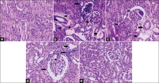 Figure 2a-e