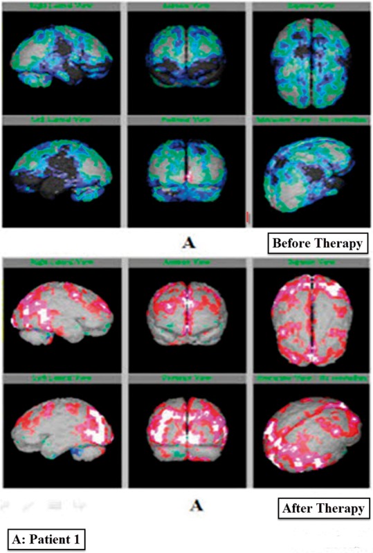 Figure 4a.