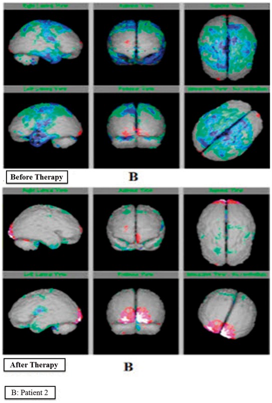 Figure 4b.