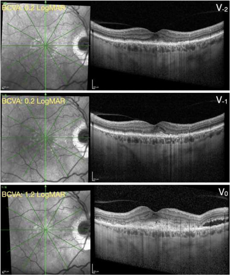 Fig. 4