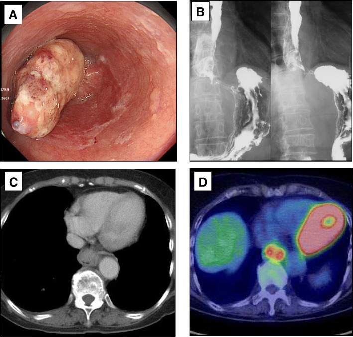 Fig. 1