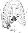 FIG. 9